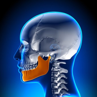 Mandibular Sagittal Split Osteotomy by OrangeCountySurgeons.org - 2